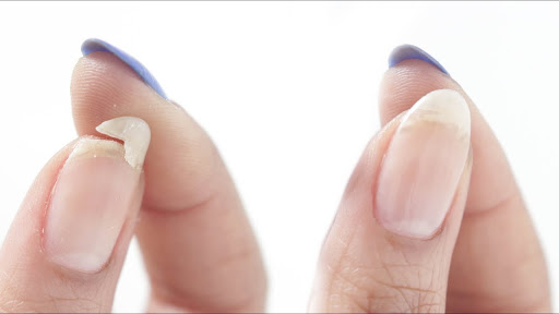 Use nail glue to fix the broken part is also a common solution. 
