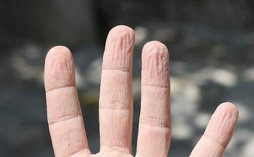 You may notice that your fingers are pruney after being in the water for a while