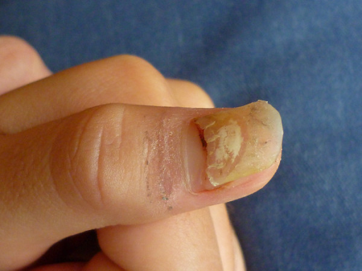 Your acrylic nails could break due to more reasons than you think.