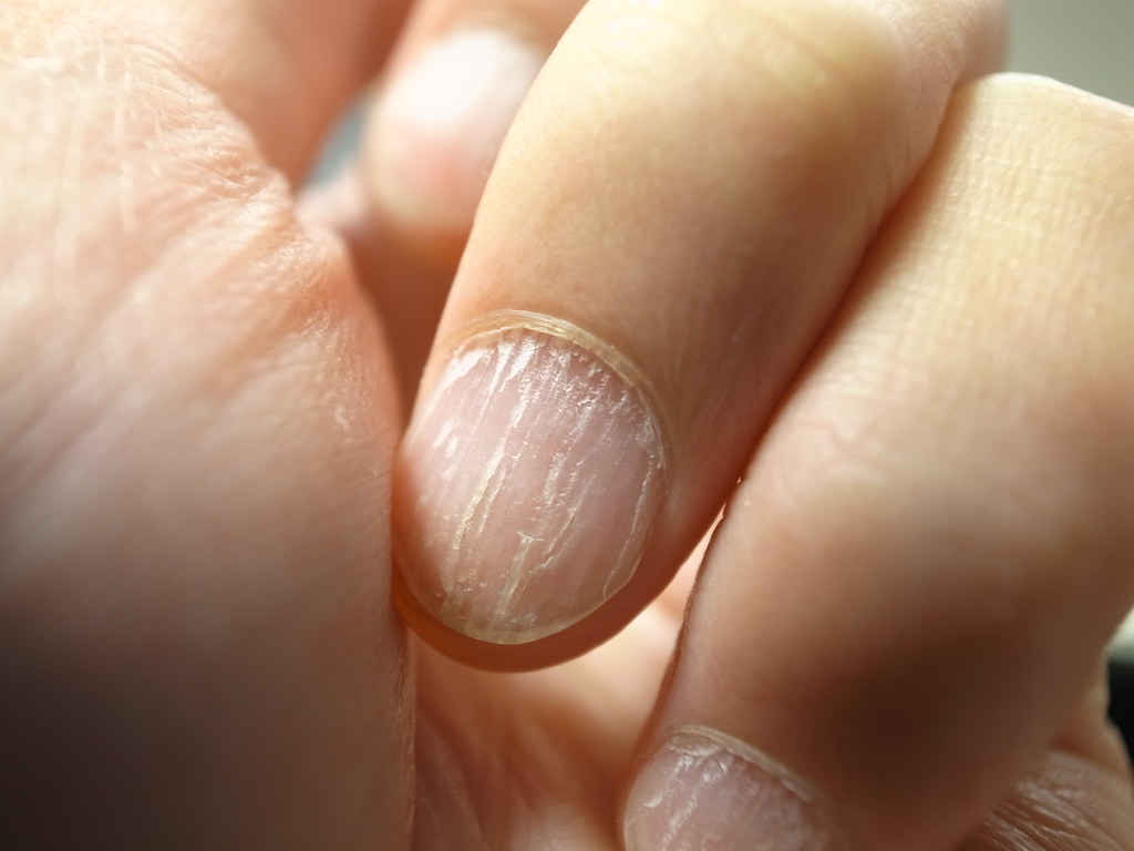Nails after removing dip powder are prone to dryness and breakage